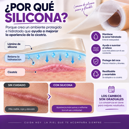 CicaFix™ | Cinta para el Cuidado de Cicatrices