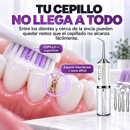 Oralyn™ — Irrigador Bucal 360° de Limpieza Profunda