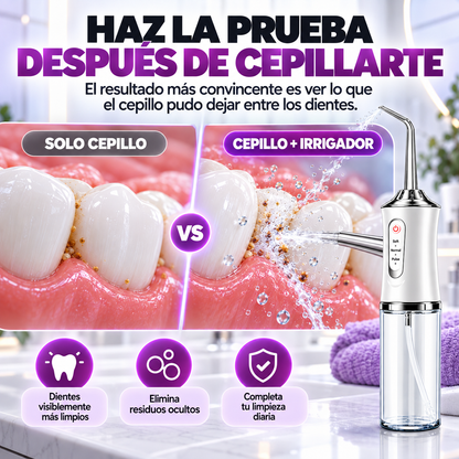 Oralyn™ — Irrigador Bucal 360° de Limpieza Profunda